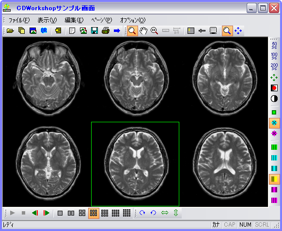CDWorkshop内臓DICOMビューア